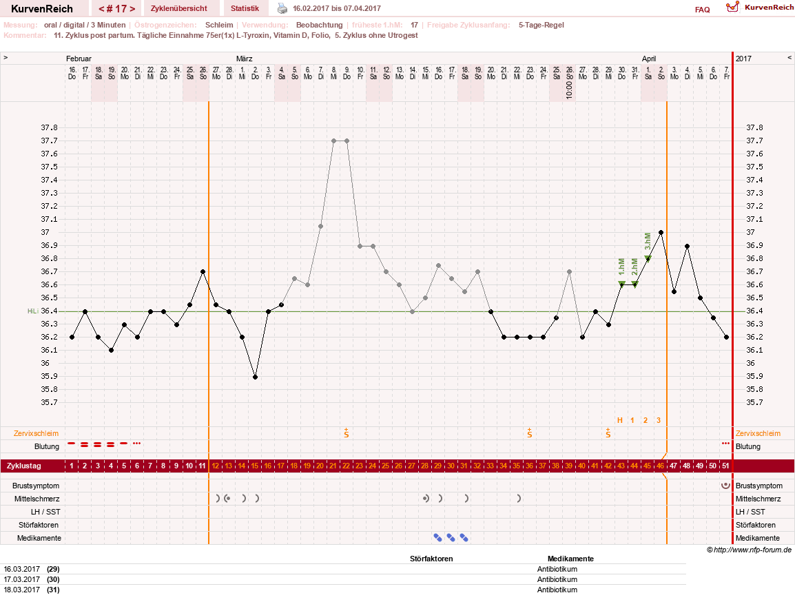 NFP-Kurve User #25900