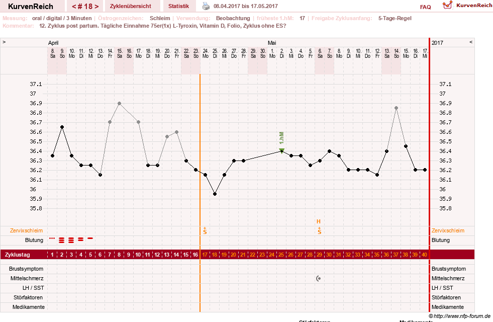 NFP-Kurve User #25900