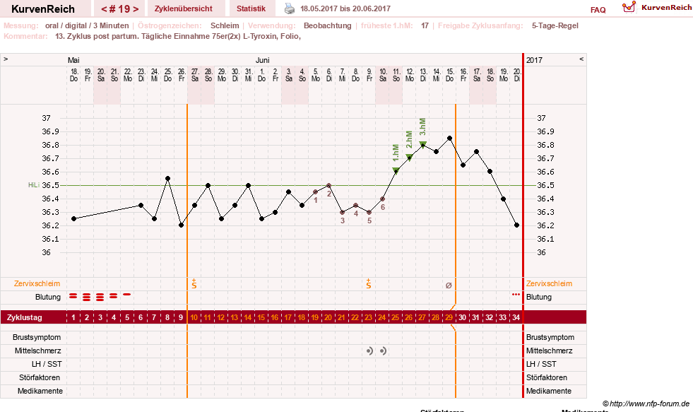 NFP-Kurve User #25900
