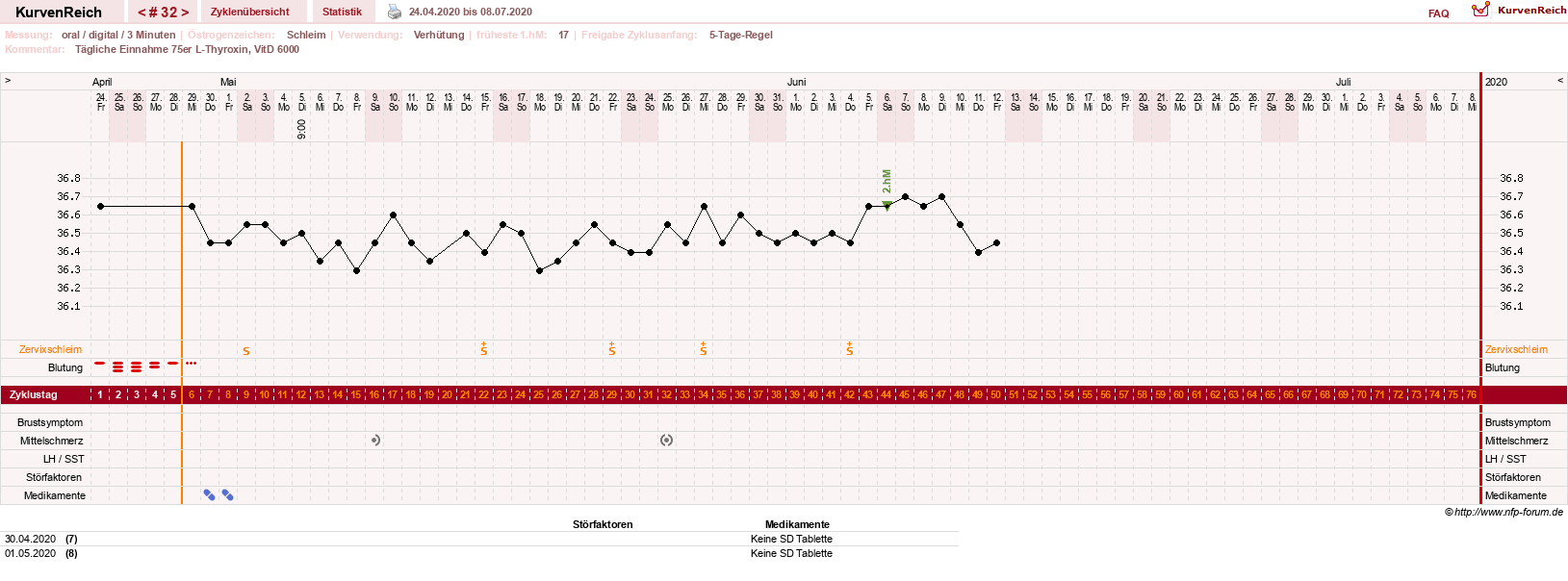 NFP-Kurve User #25900