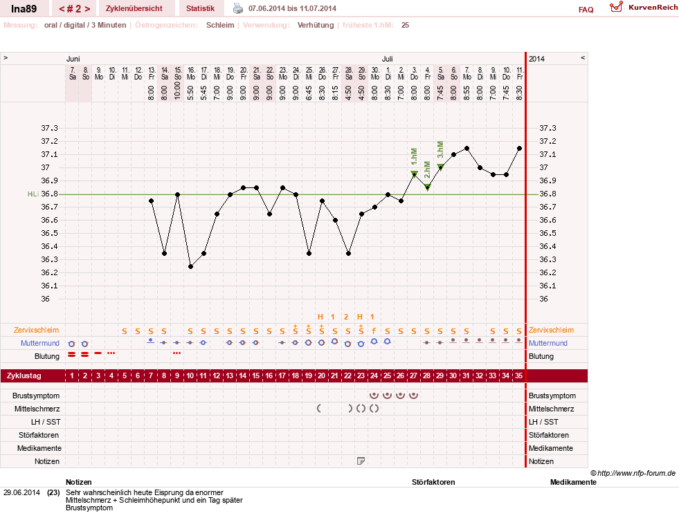 NFP-Kurve User #25952