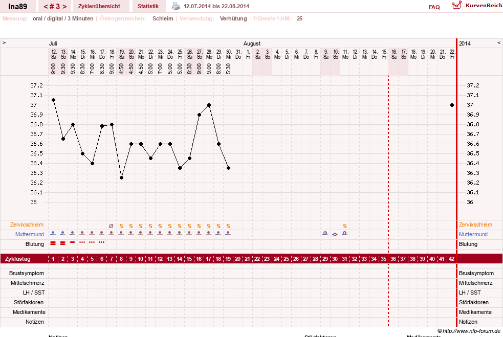 NFP-Kurve User #25952