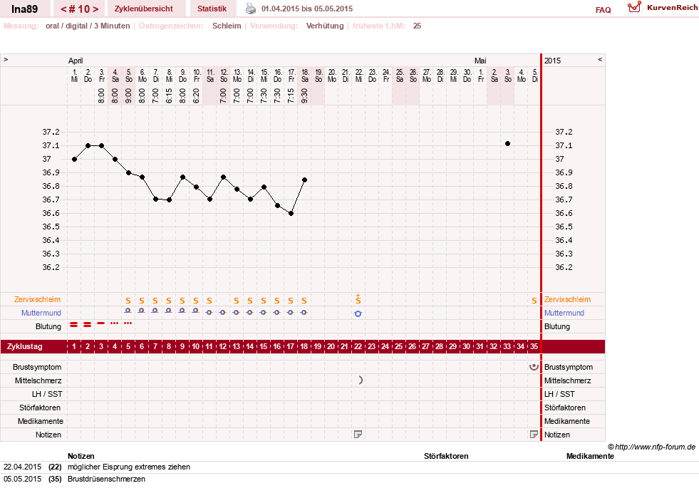 NFP-Kurve User #25952