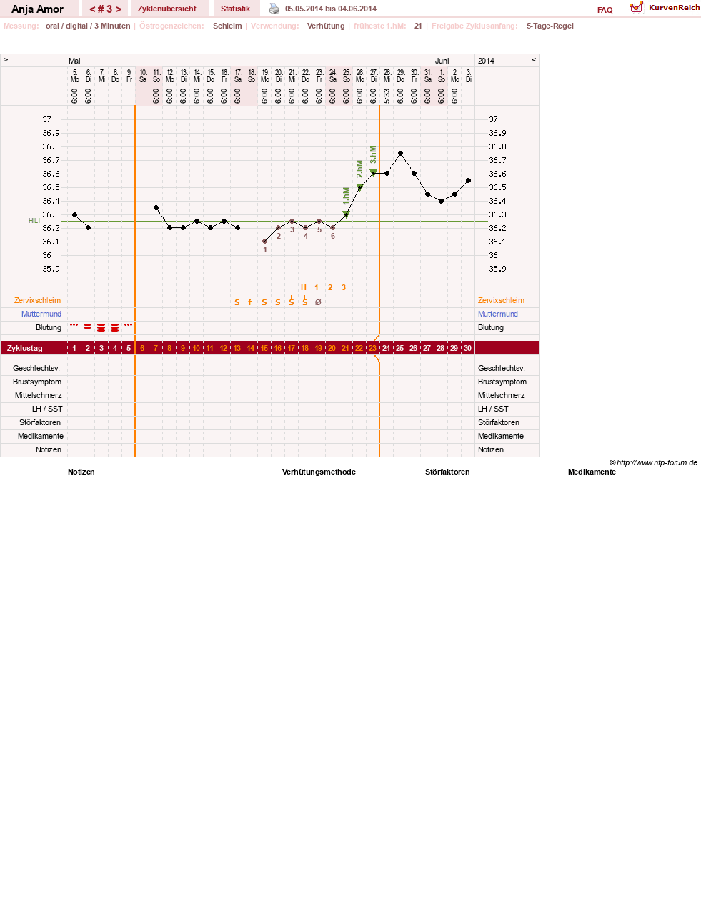 NFP-Kurve User #26066