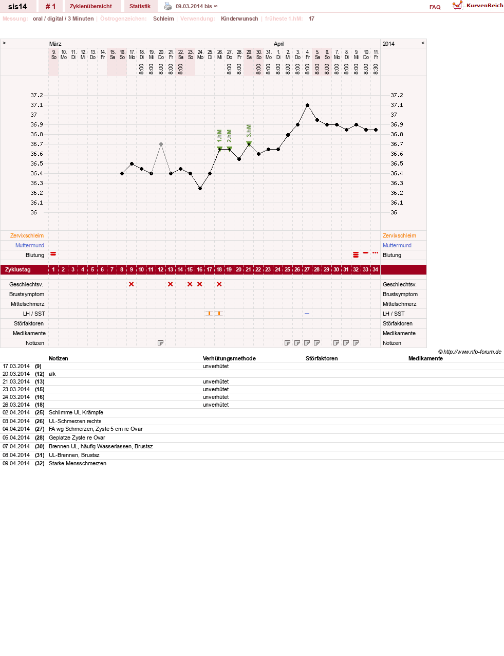 NFP-Kurve User #26122