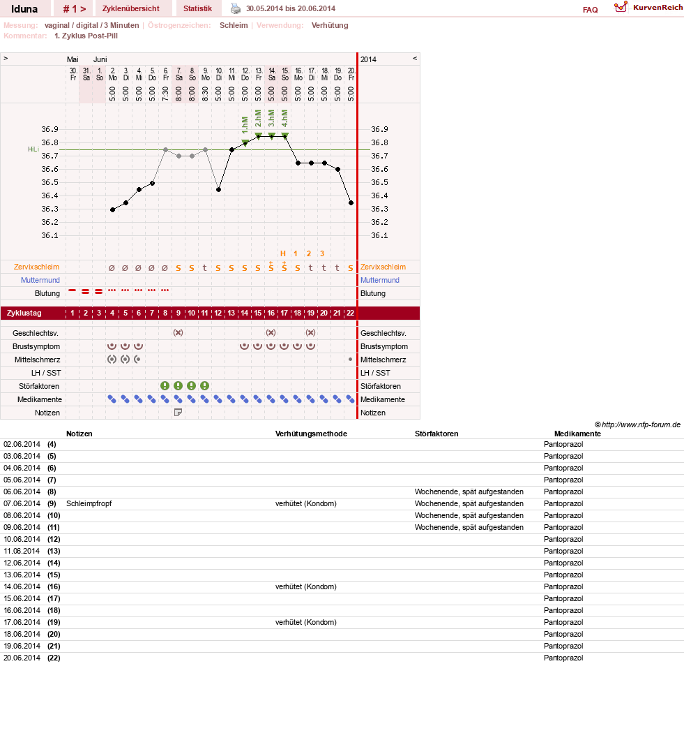 NFP-Kurve User #26174