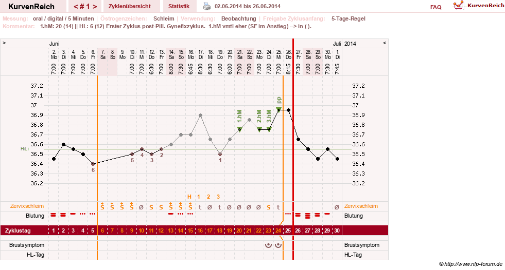 NFP-Kurve User #26187