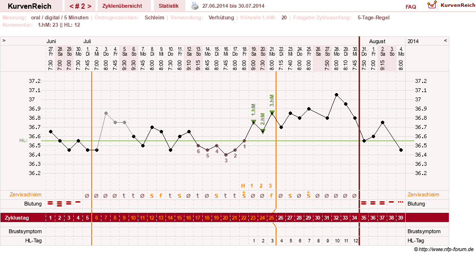 NFP-Kurve User #26187