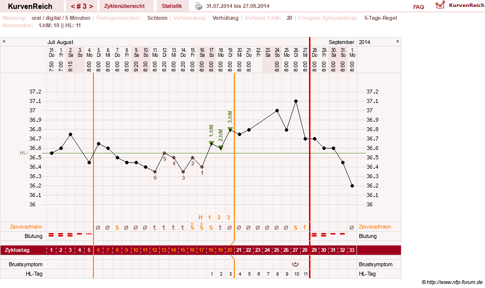 NFP-Kurve User #26187