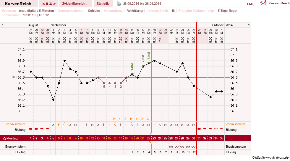 NFP-Kurve User #26187