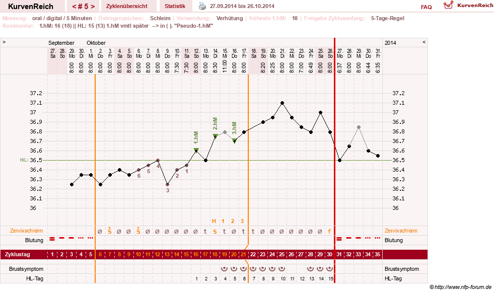 NFP-Kurve User #26187