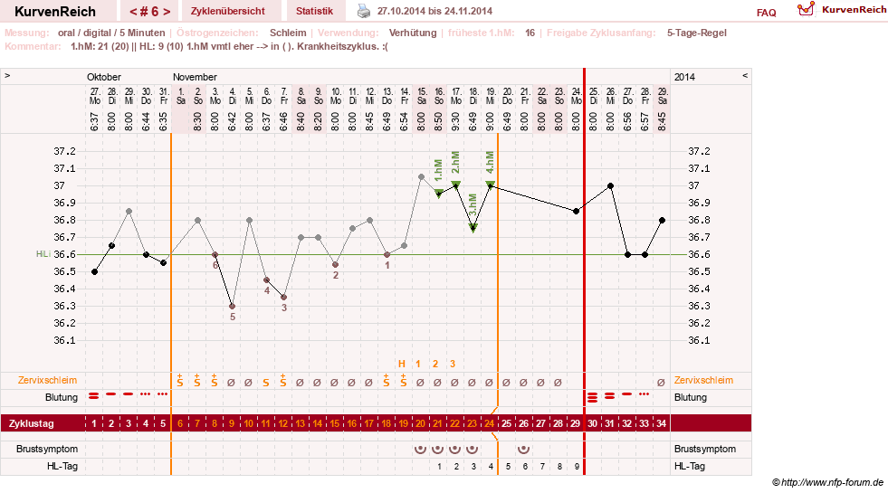 NFP-Kurve User #26187