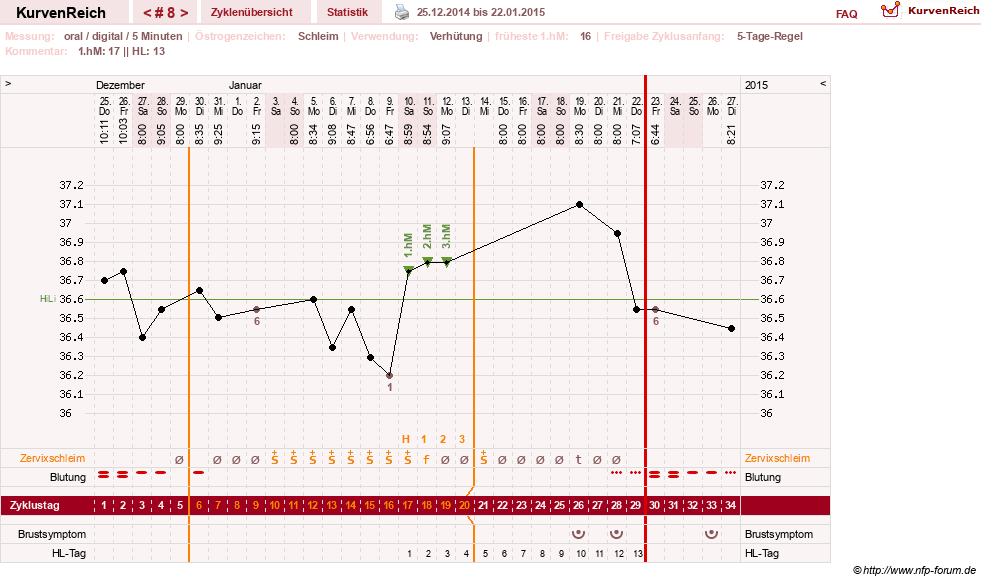 NFP-Kurve User #26187
