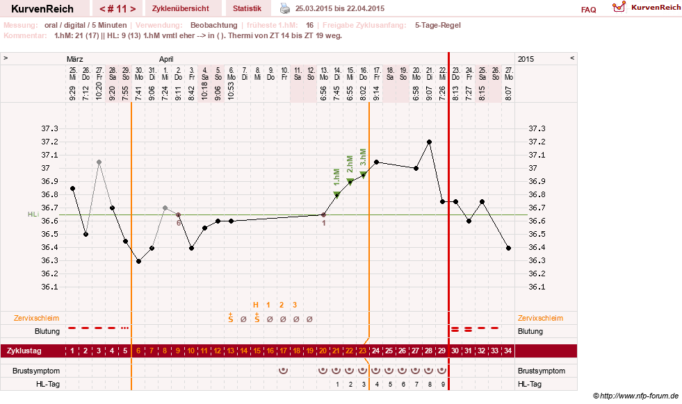 NFP-Kurve User #26187