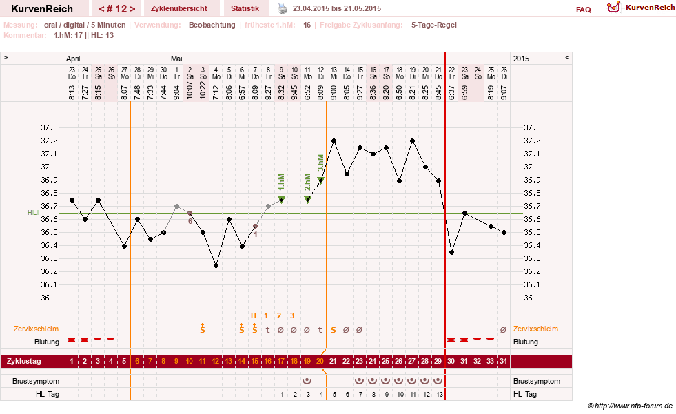 NFP-Kurve User #26187
