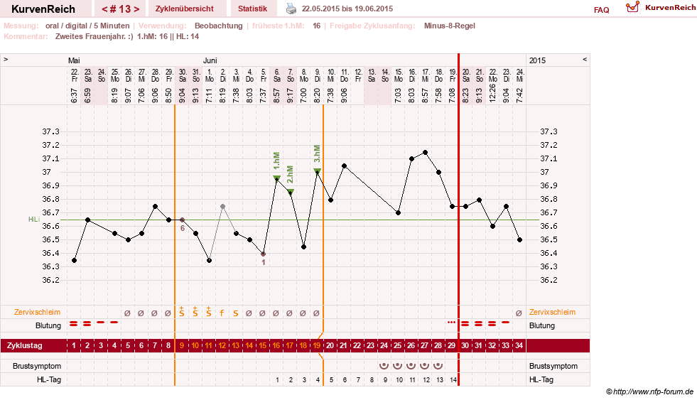 NFP-Kurve User #26187