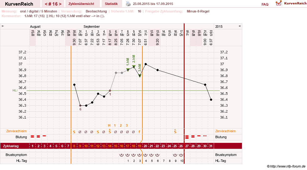NFP-Kurve User #26187