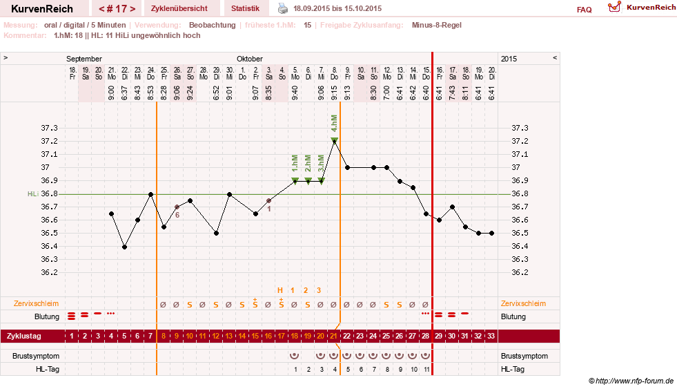 NFP-Kurve User #26187