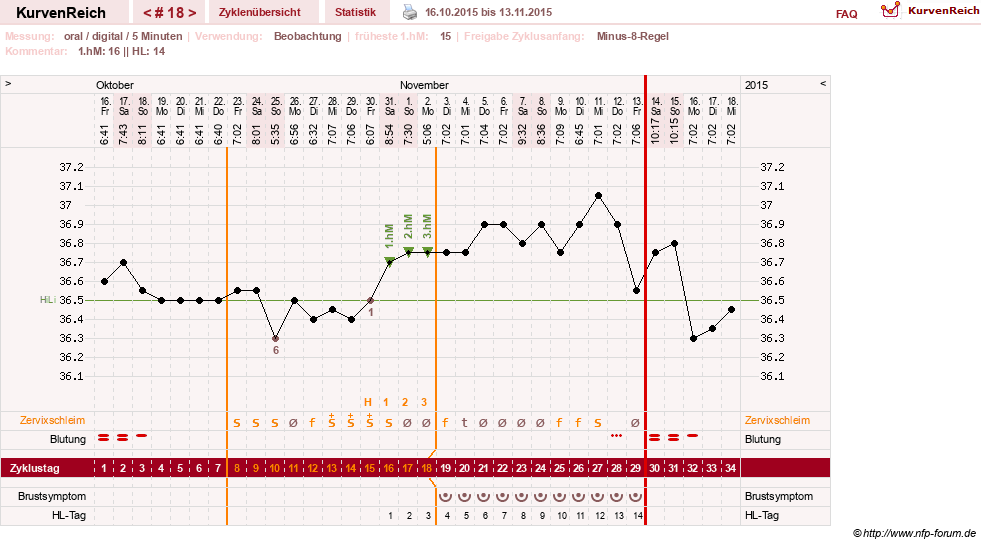 NFP-Kurve User #26187