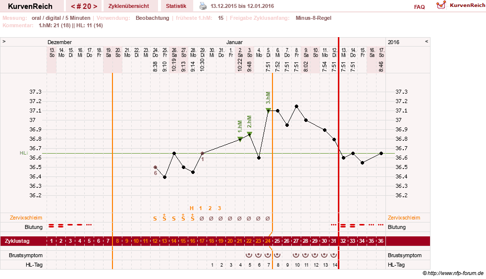 NFP-Kurve User #26187