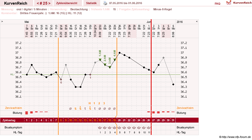 NFP-Kurve User #26187