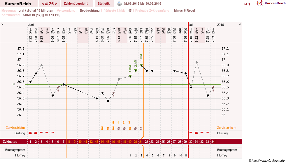 NFP-Kurve User #26187