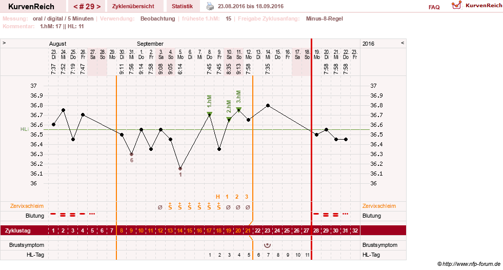 NFP-Kurve User #26187