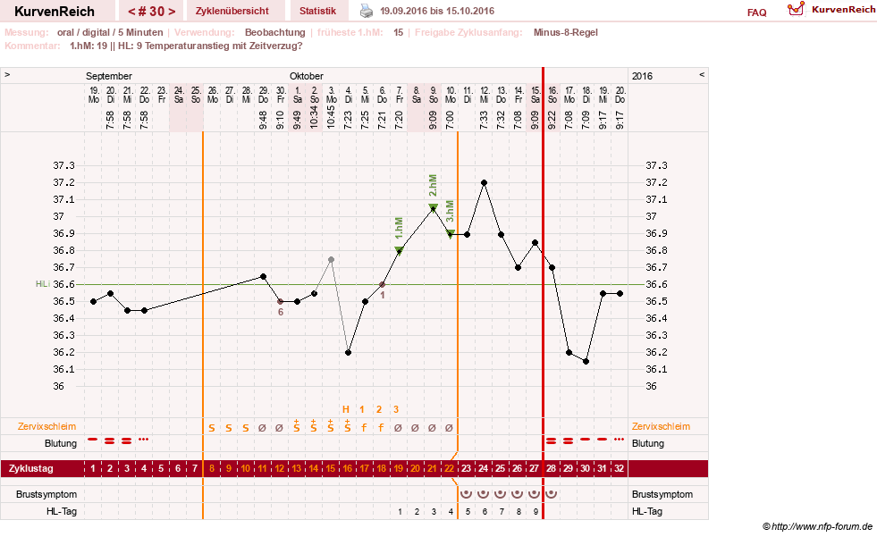 NFP-Kurve User #26187
