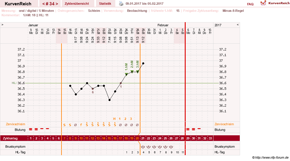 NFP-Kurve User #26187