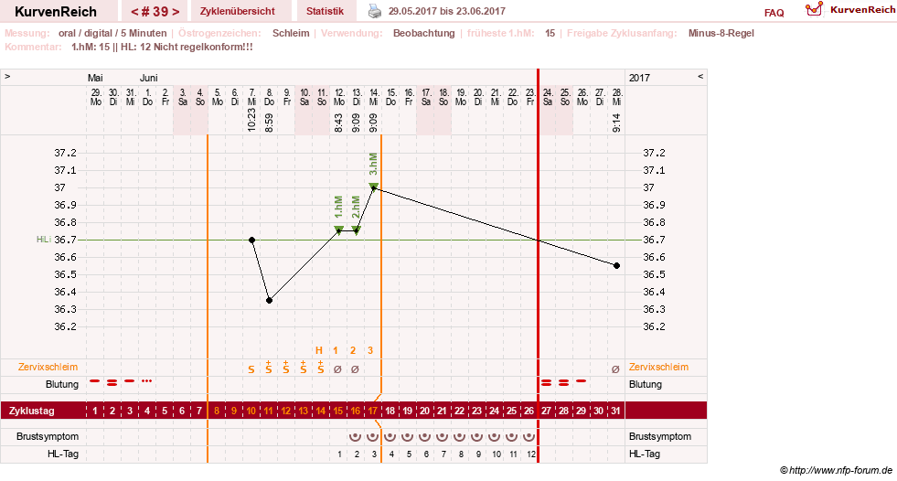 NFP-Kurve User #26187