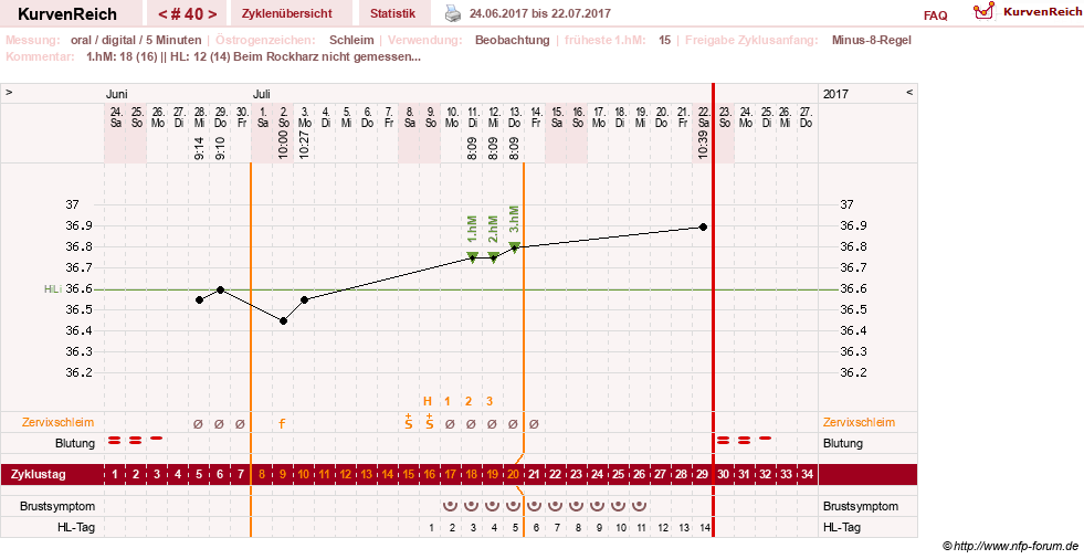 NFP-Kurve User #26187