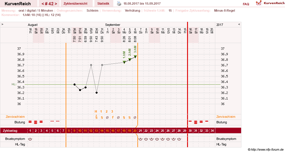 NFP-Kurve User #26187