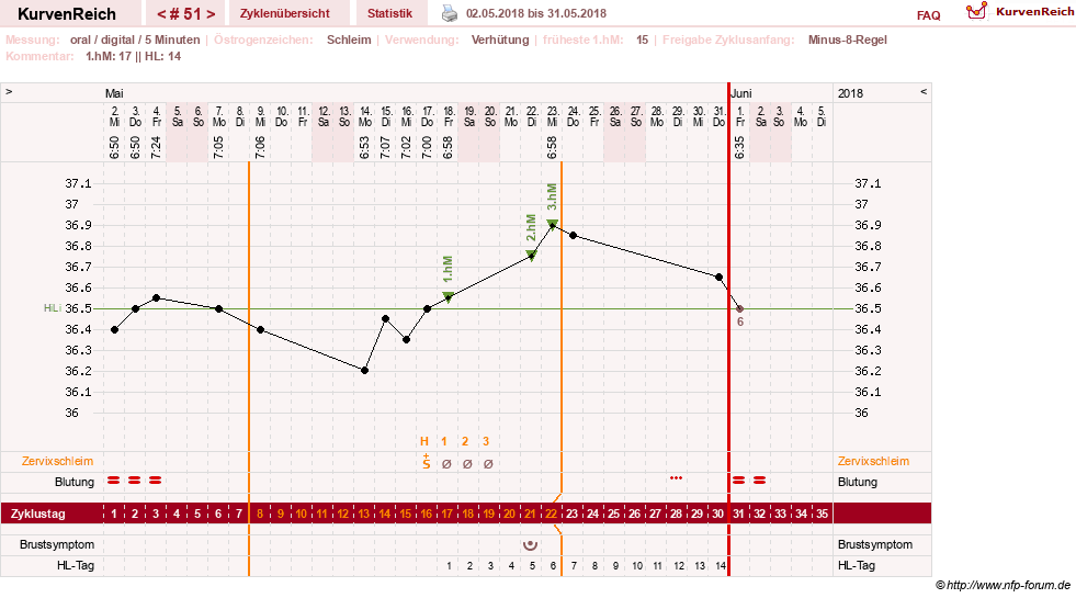 NFP-Kurve User #26187