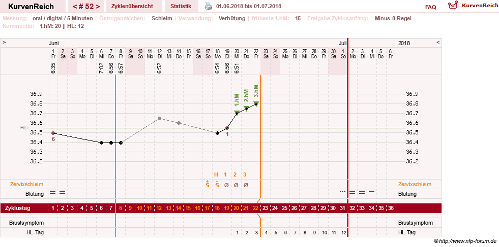NFP-Kurve User #26187