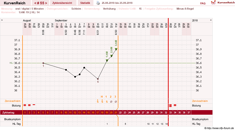 NFP-Kurve User #26187
