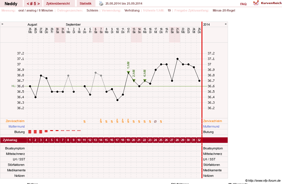 NFP-Kurve User #26207