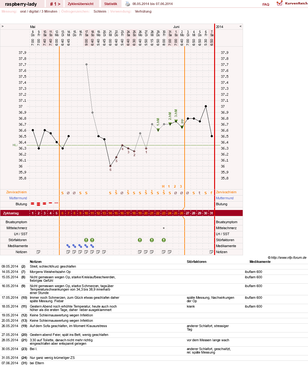 NFP-Kurve User #26226