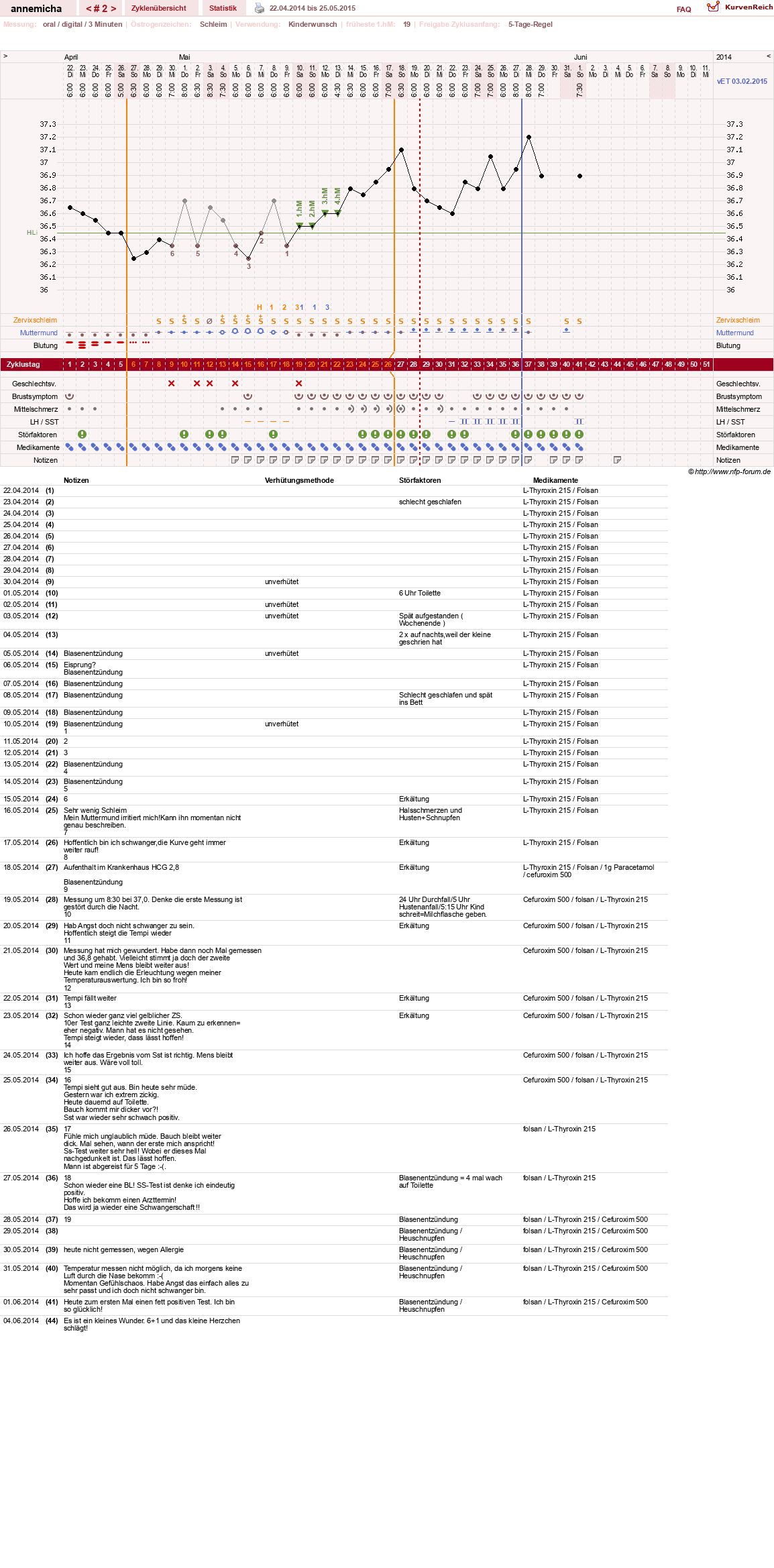 NFP-Kurve User #26258
