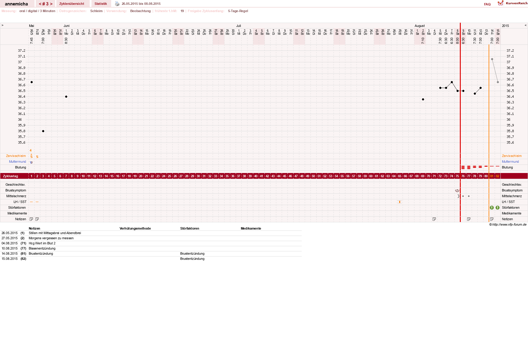 NFP-Kurve User #26258