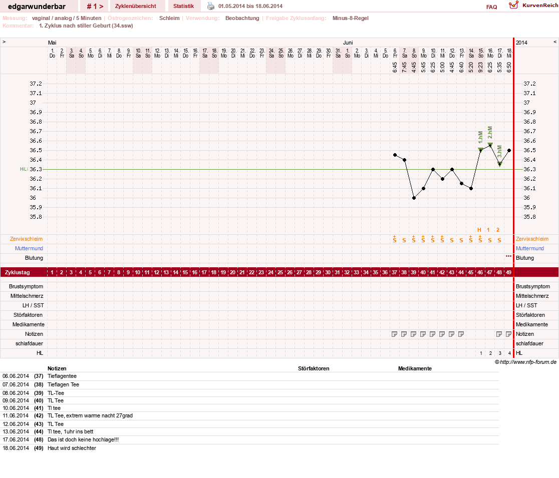 NFP-Kurve User #26435