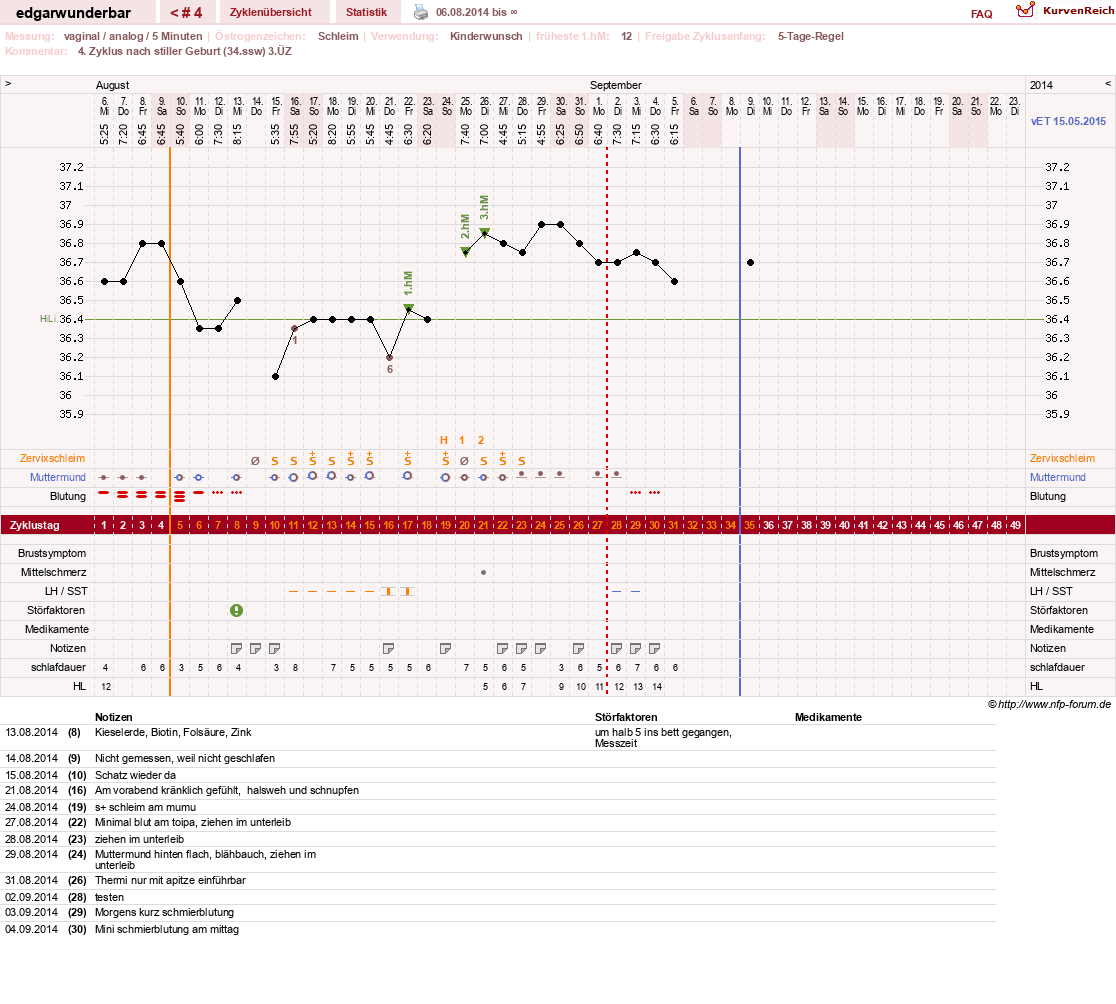 NFP-Kurve User #26435