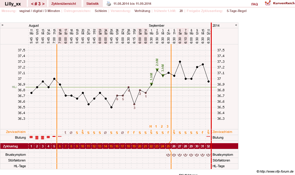 NFP-Kurve User #26447