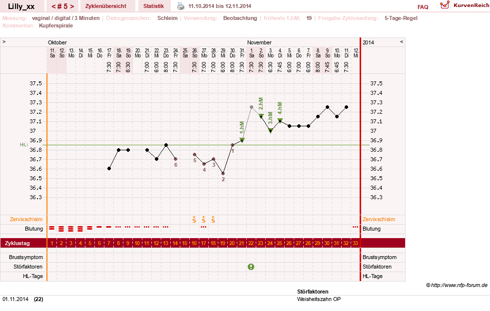 NFP-Kurve User #26447