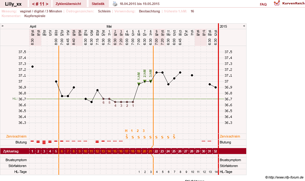 NFP-Kurve User #26447