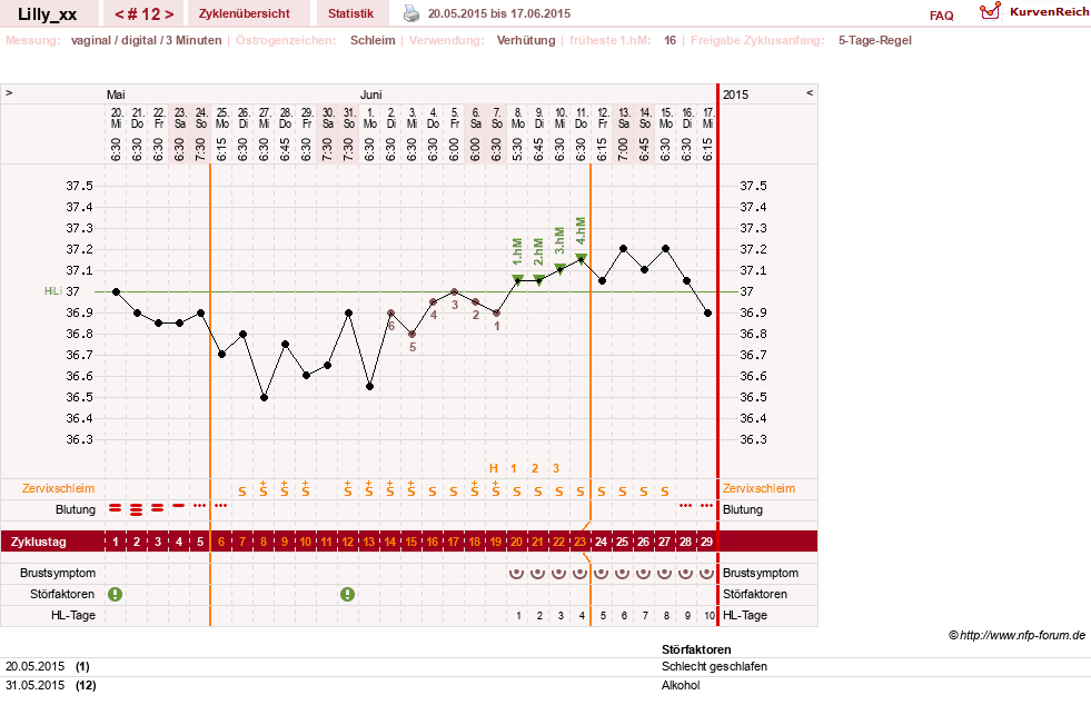 NFP-Kurve User #26447