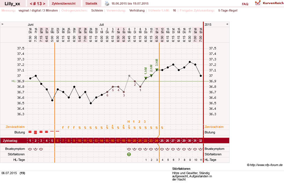 NFP-Kurve User #26447