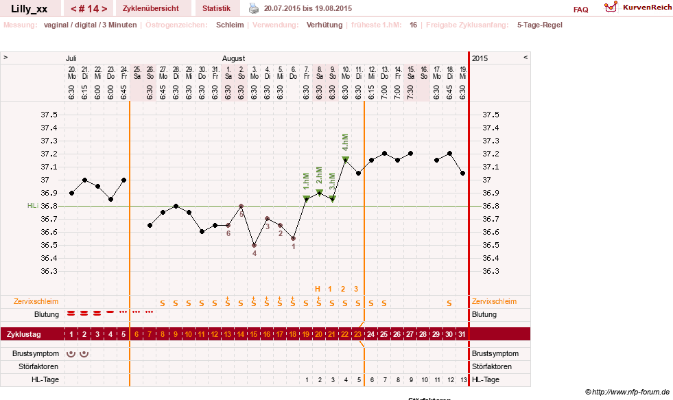 NFP-Kurve User #26447