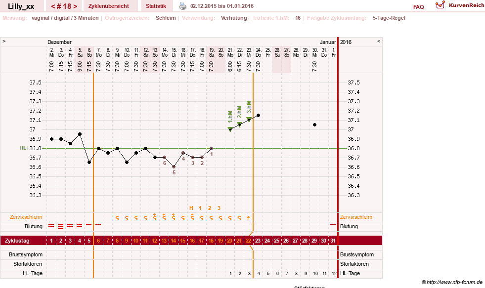 NFP-Kurve User #26447