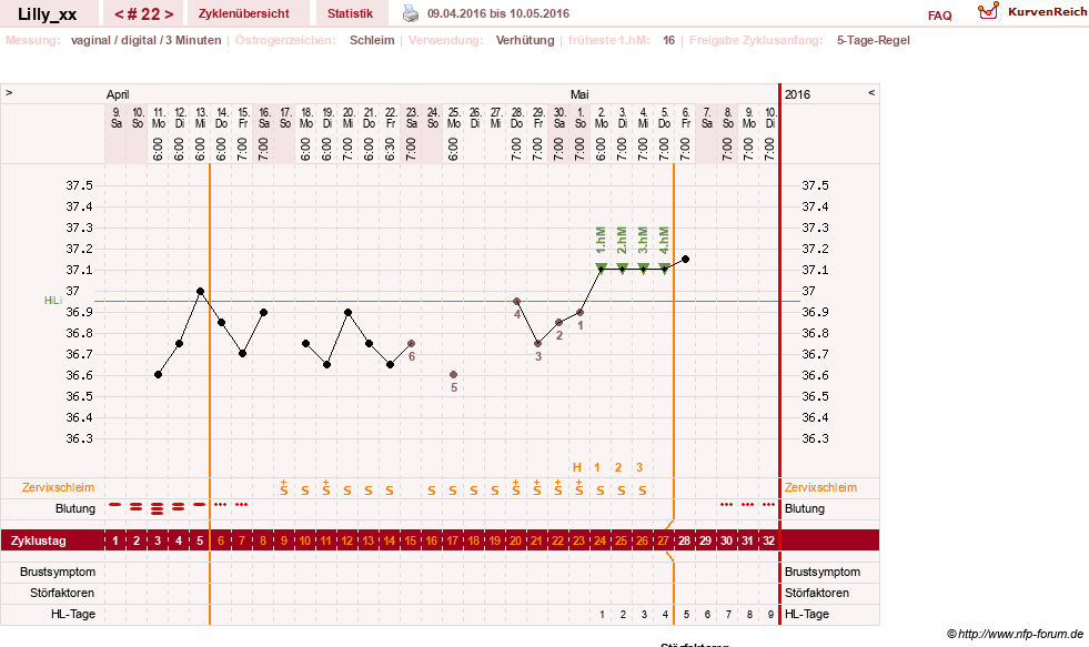 NFP-Kurve User #26447