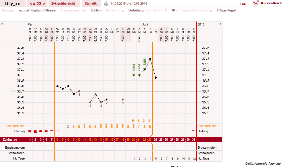 NFP-Kurve User #26447